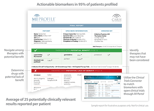 Screenshot of Sample MI Profile Report